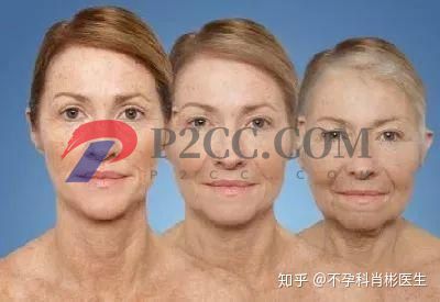 40歲絕經和55歲絕經有什么區別?(圖2)
