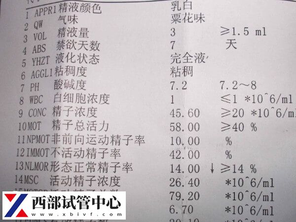 試管反復失敗的原因是什么