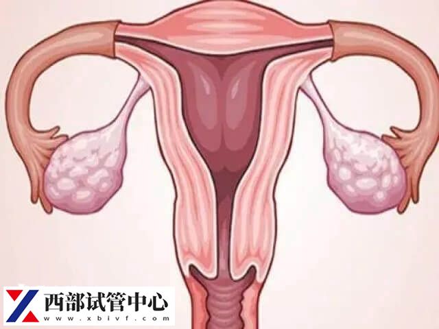 輸卵管積水可以做試管解決