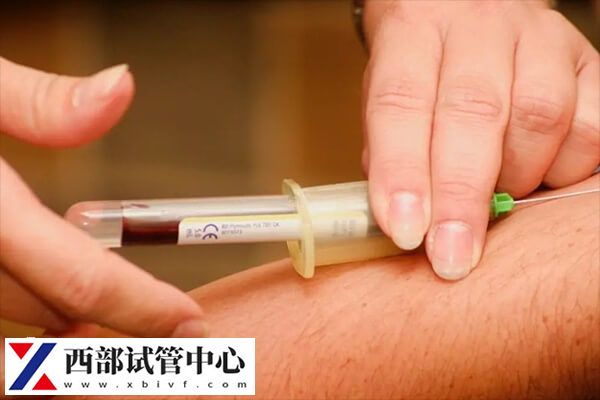 amh0.28能不能做試管嬰兒