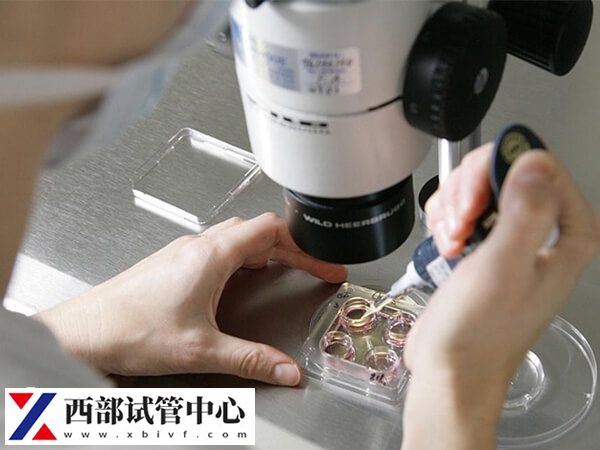 試管對amh值沒有要求