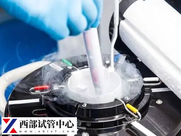 卵源配對是做供卵試管的流程之一