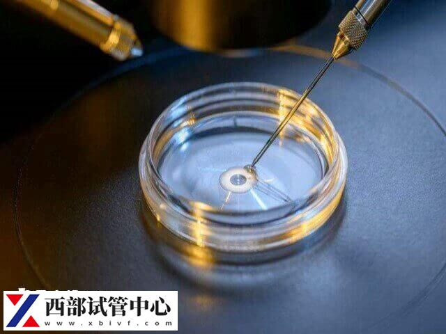 男性符合適應癥是做供精試管的條件之一