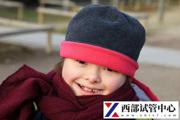 唐氏綜合癥風險度如何看