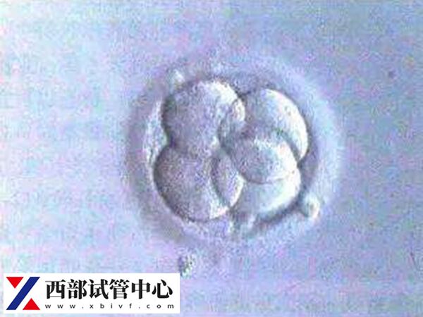 平衡易位會遺傳給后代